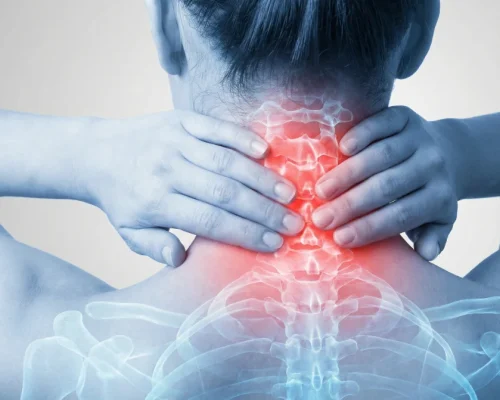 Neck-Pain.webp
