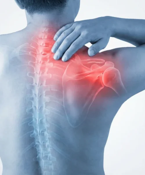 Shoulder-Pain.webp